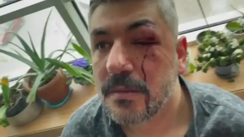 Bu nasıl eğitimci. Okul müdürü hem öğrenciyi hem babasını dövdü