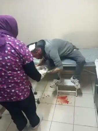 Seçim bürosunda 'bastonlu' kavga. Başından yaralandı
